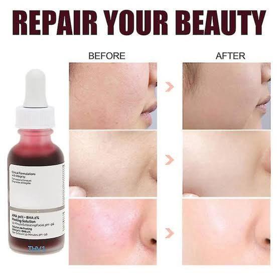 سرم لایه بردار اوردینری پیلینگ کانادایی اصل The Ordinary | AHA 30% + BHA 2% Peeling Solution